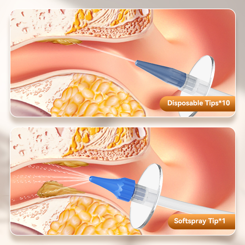 Ear Wax Removal Manual Oor Irr - Smart Garden Watering System recensie en prijs